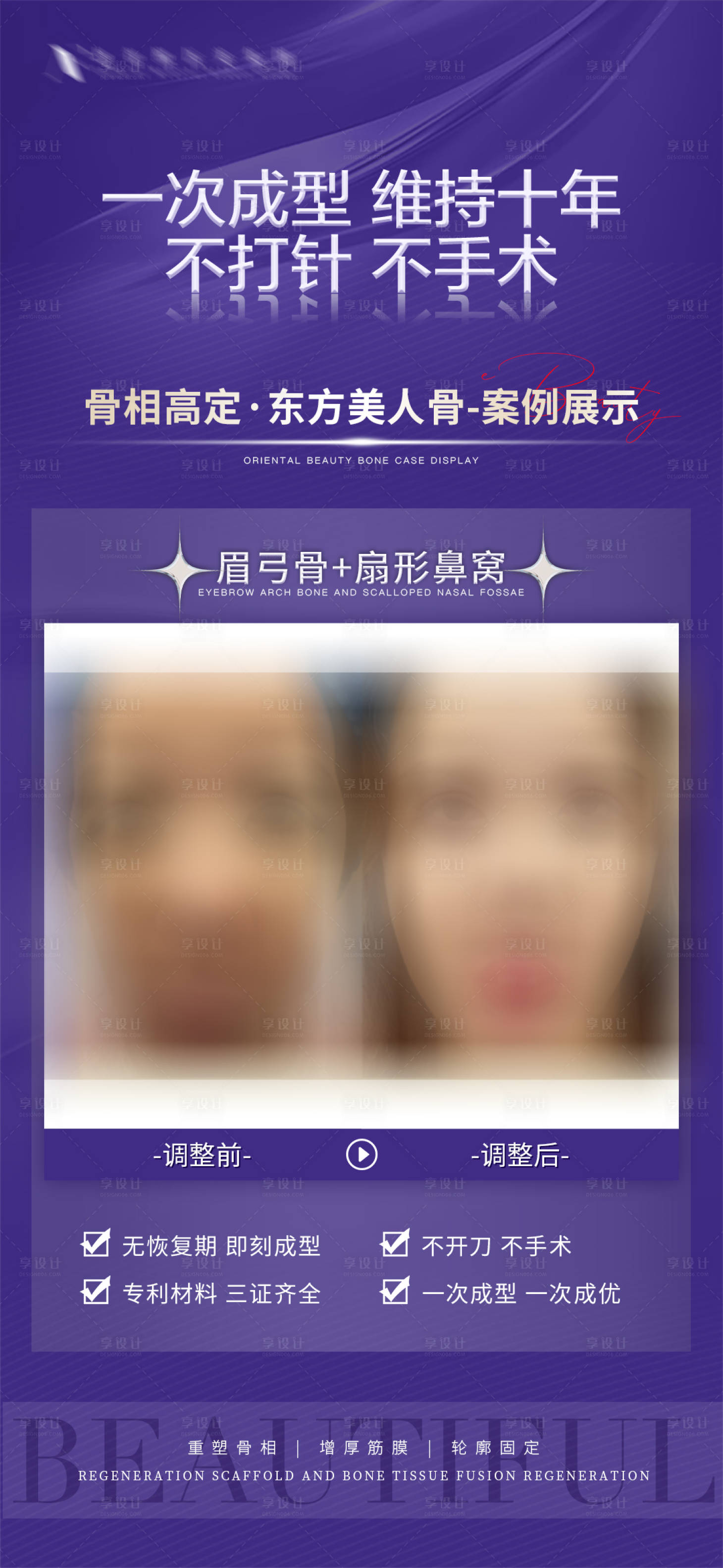 源文件下載【享設(shè)計(jì)】搜索編號(hào)：12340017210416834【醫(yī)美案例海報(bào)】