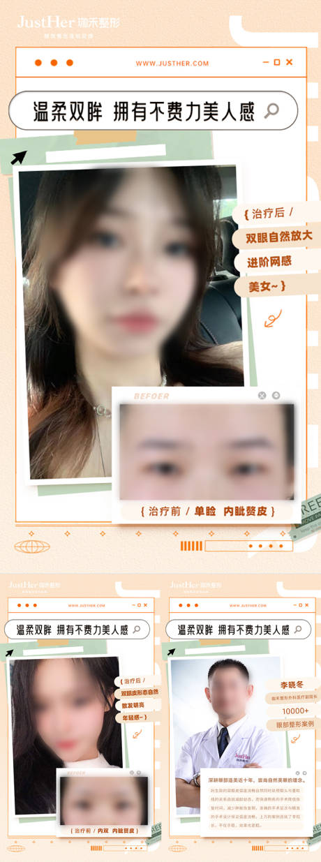 源文件下载【双眼皮案例对比海报】编号：26680018371243329