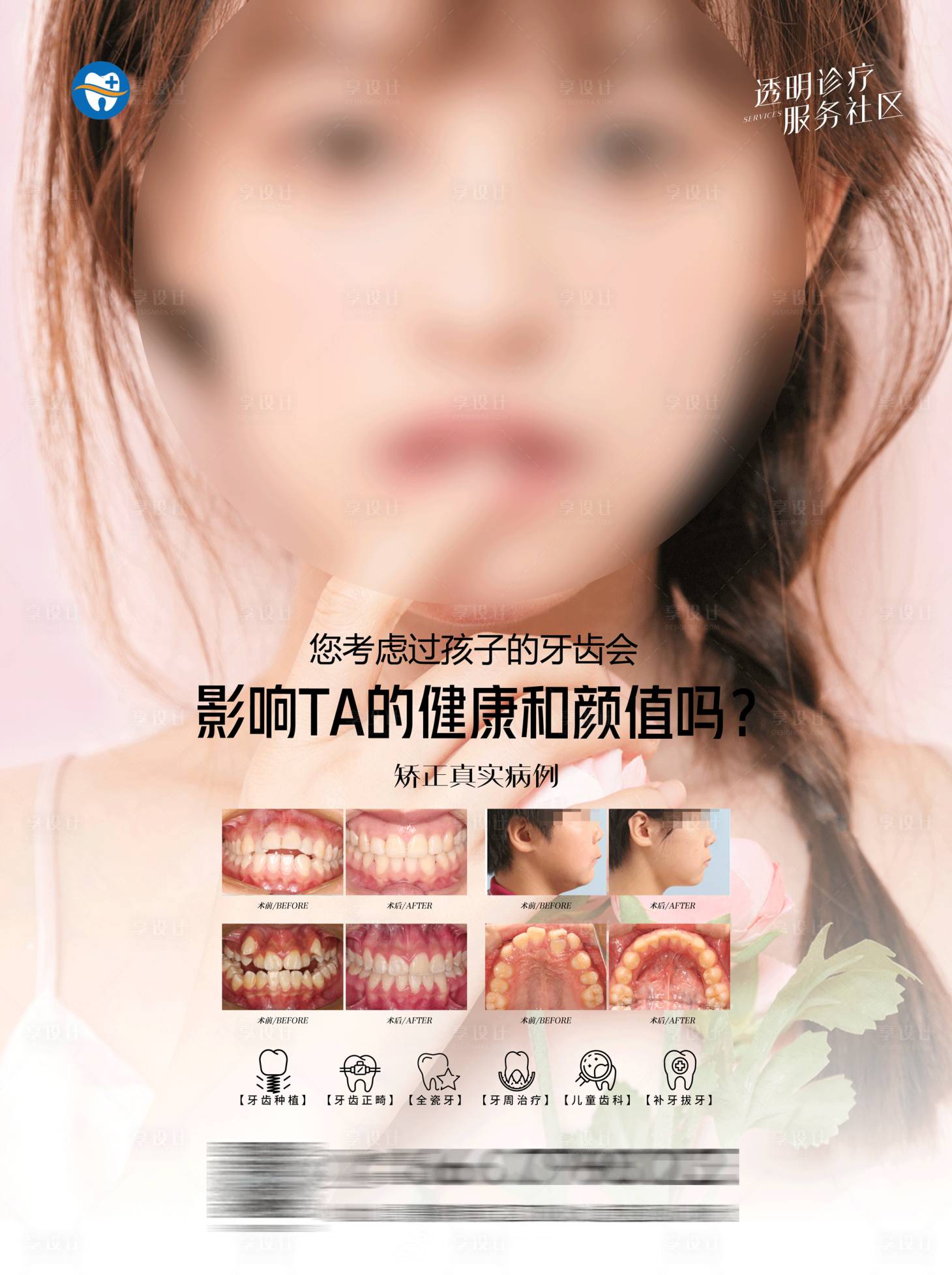 源文件下載【享設計】搜索編號：94360018080919241【口腔案例電梯海報】