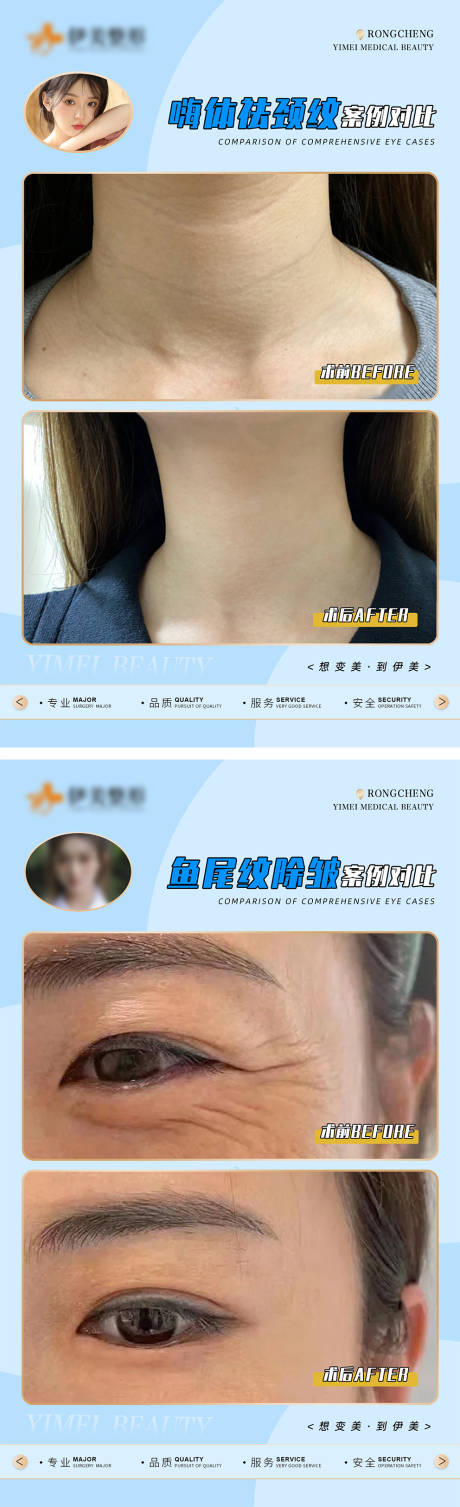 源文件下载【医美案例对比模版海报】编号：54550018273314386