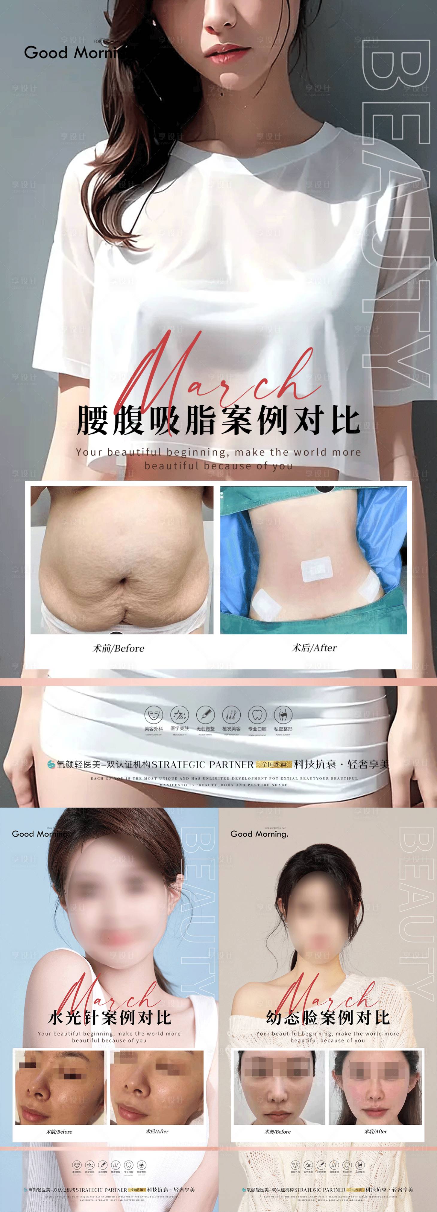 源文件下載【享設(shè)計(jì)】搜索編號：39170018092018869【整形案例1】