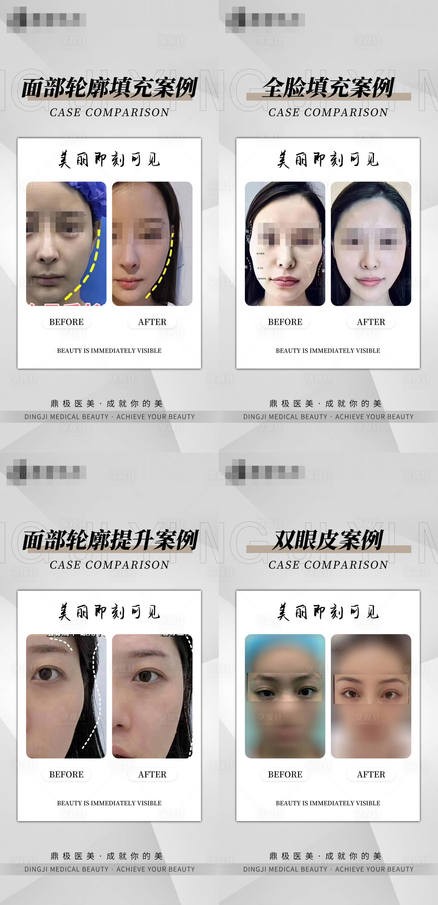 源文件下载【医美简约案例合集海报】编号：29310017843984427