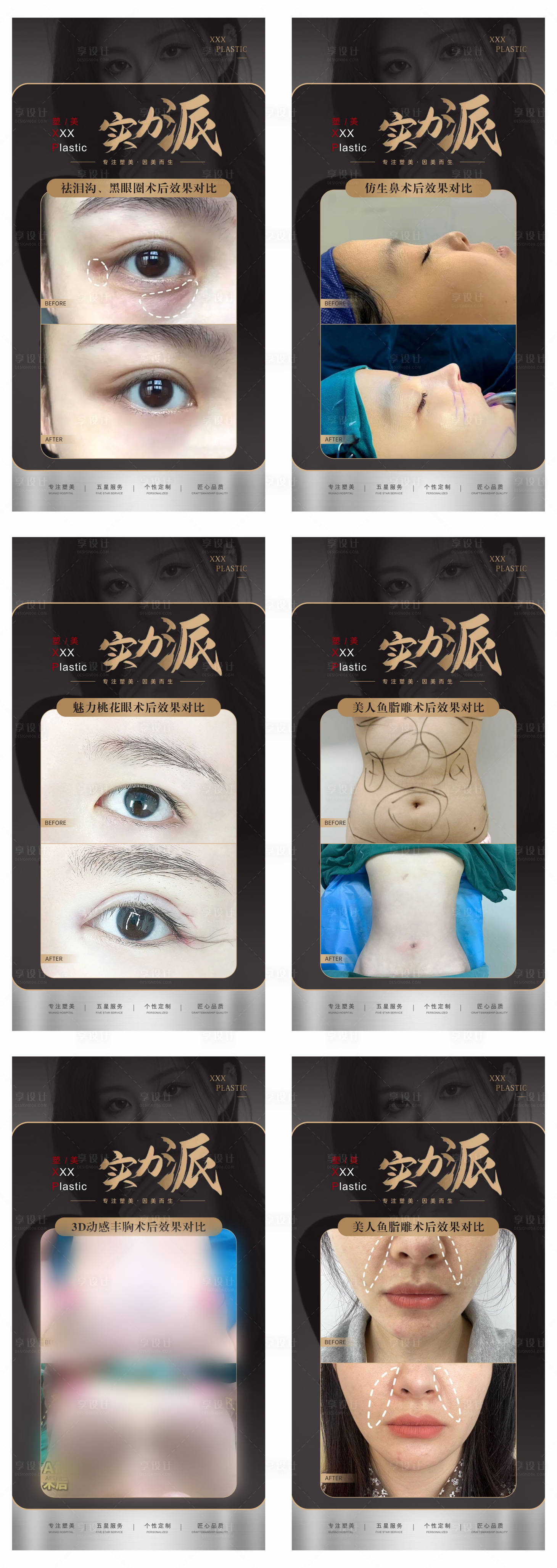 源文件下载【医美整形美容案例对比系列海报】编号：65310017903494349