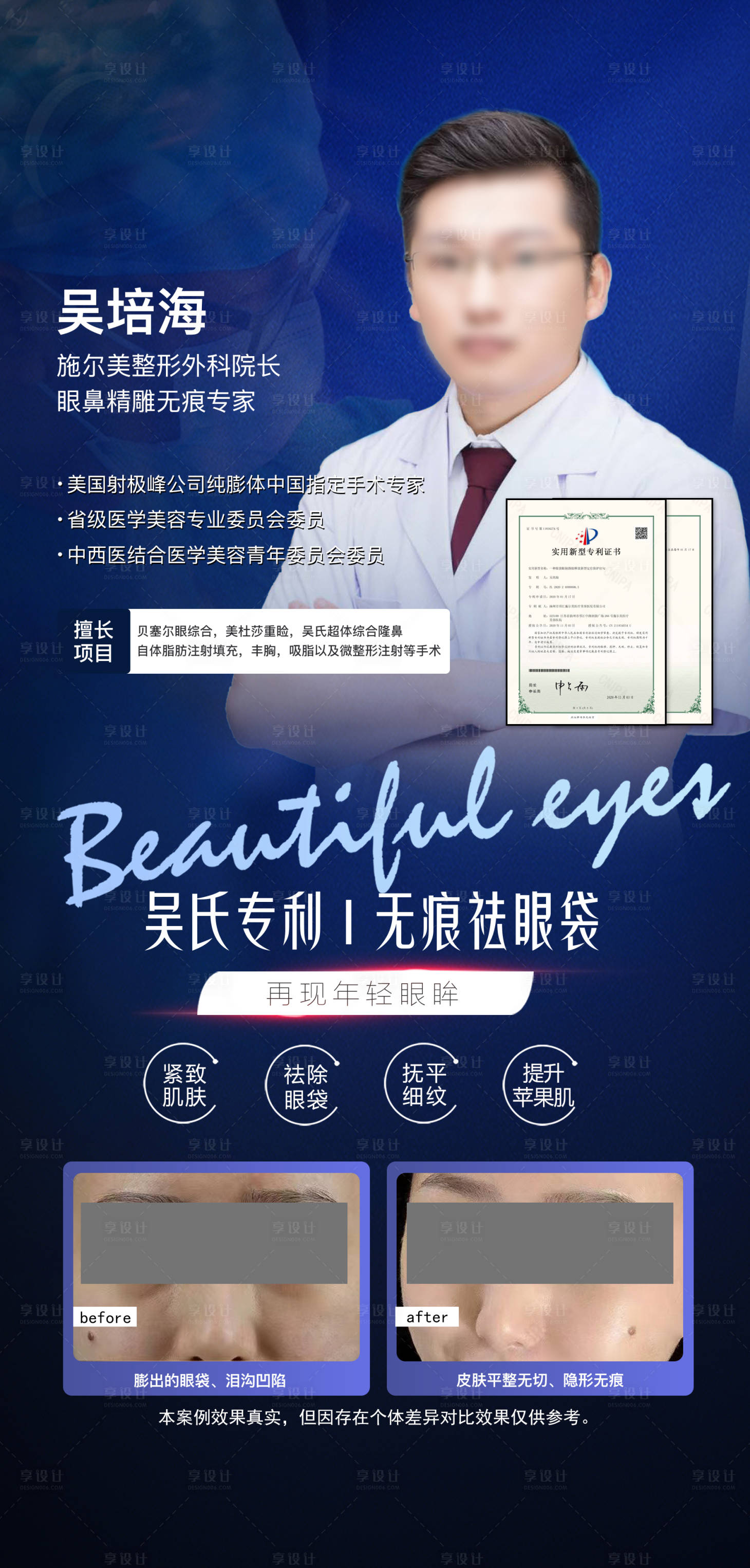 源文件下载【专利双眼皮海报】编号：62740018175913076