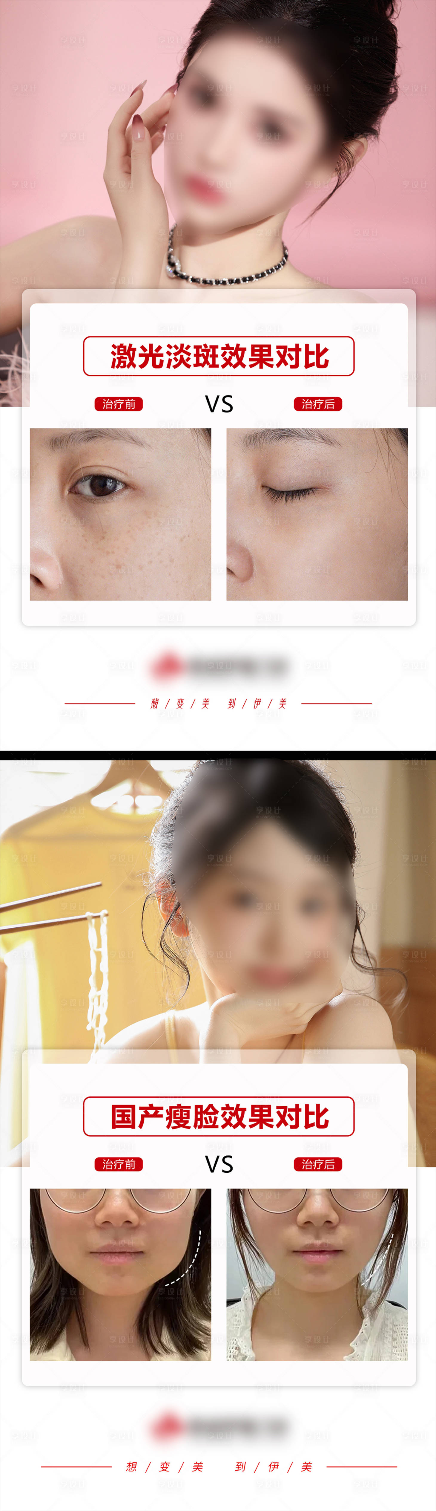 源文件下载【医美案例对比模版】编号：70830018227895386