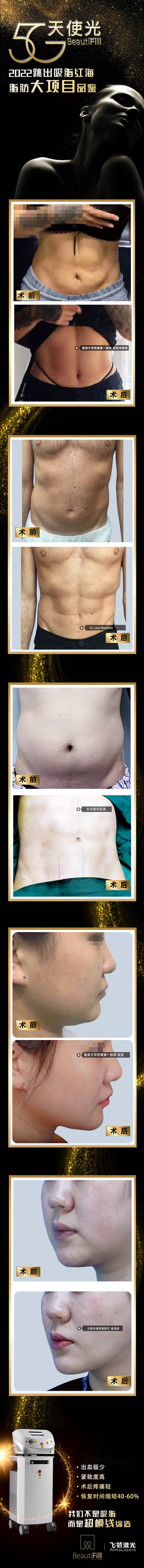 源文件下载【医美天使光对比案例长图】编号：39680017833551338