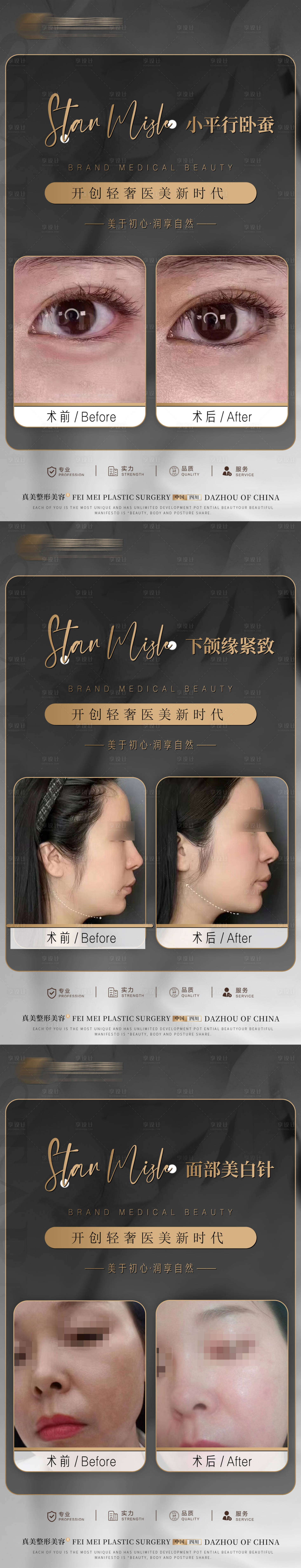 源文件下载【享设计】搜索编号：42050018352538060【医美案例对比系列海报】
