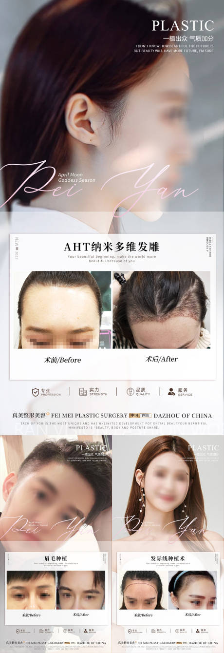 源文件下载【植发案例对比海报】编号：43900018377492397