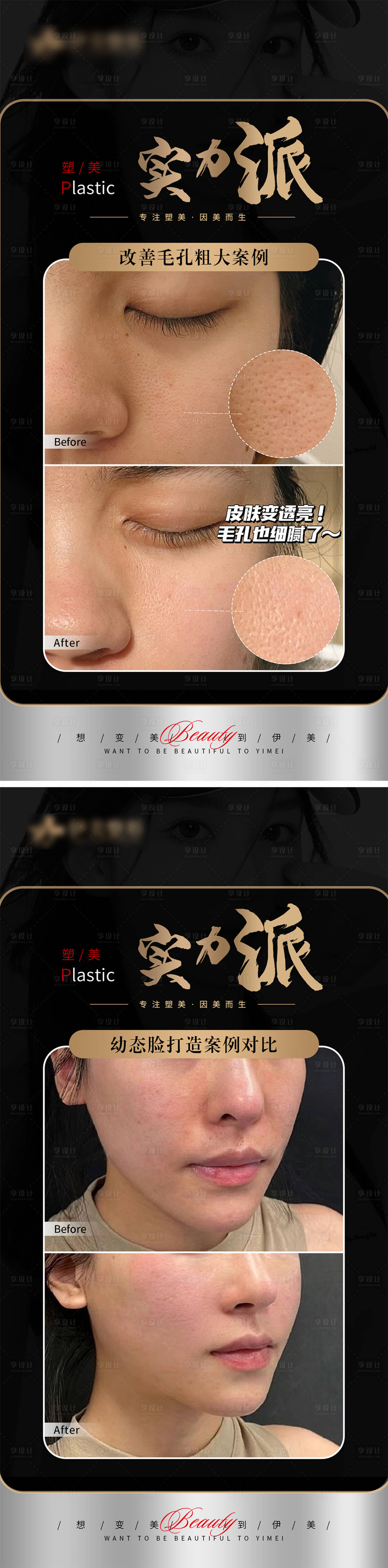 源文件下载【医美案例对比模版海报】编号：54140018329982181
