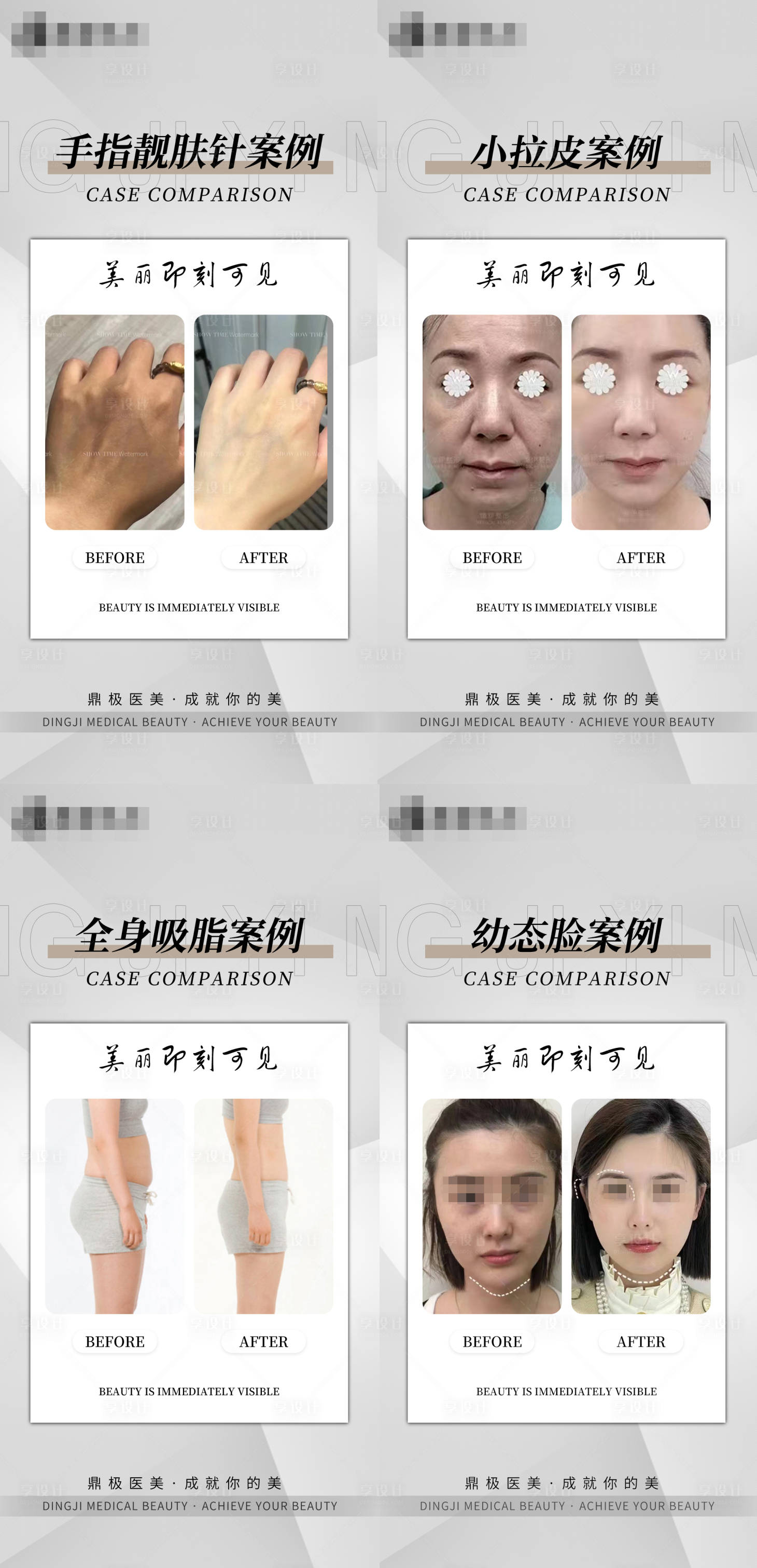 源文件下載【享設計】搜索編號：35510018091745874【醫美案例】