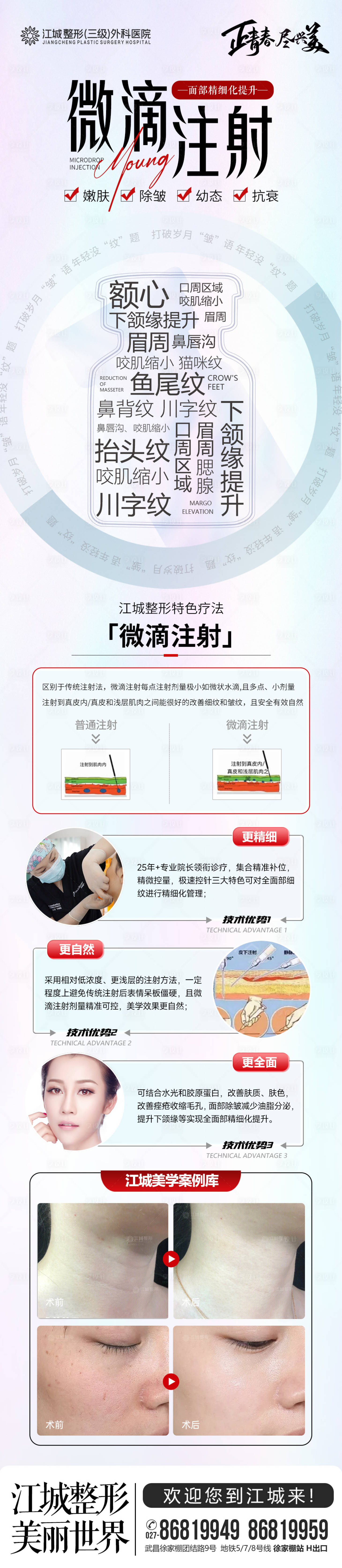 源文件下载【微滴注射】编号：45530018128334955