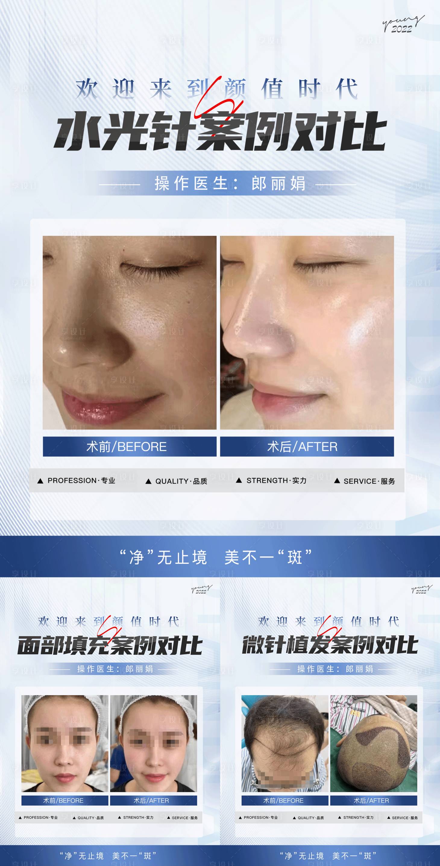 源文件下載【享設(shè)計】搜索編號：43000017980536048【醫(yī)美整形植發(fā)案例海報  】