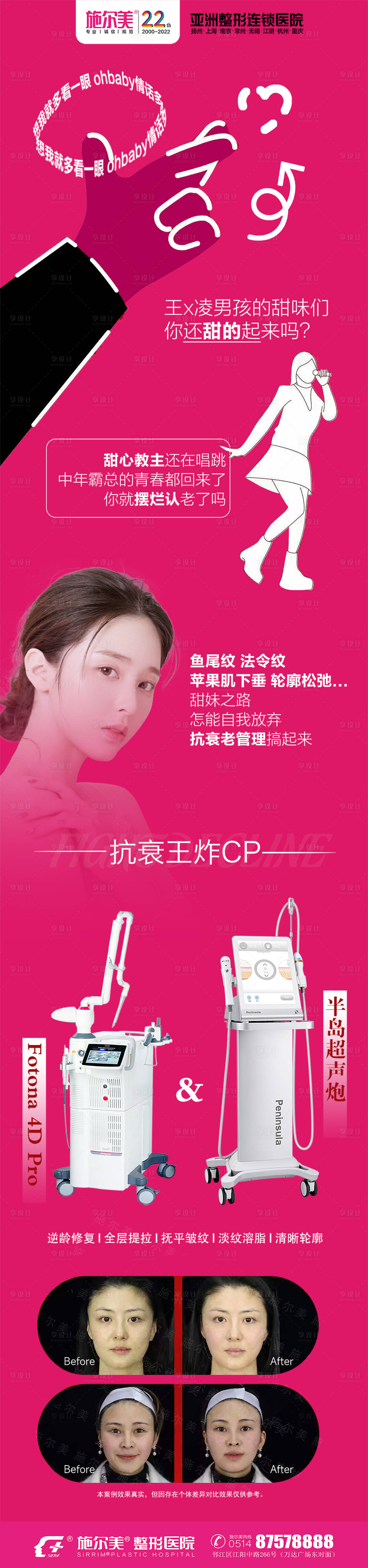源文件下載【享設計】搜索編號：59790018138912294【Fotona4DPro超聲炮】