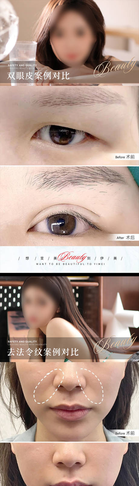 源文件下载【享设计】搜索编号：35420018282246623【医美案例对比】