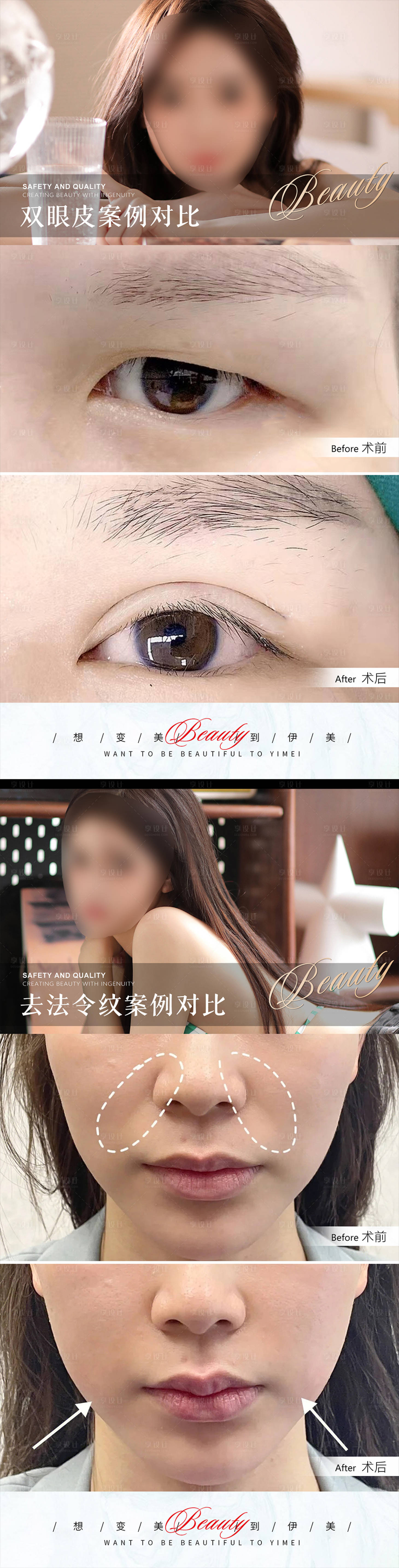 源文件下載【享設(shè)計】搜索編號：35420018282246623【醫(yī)美案例對比】
