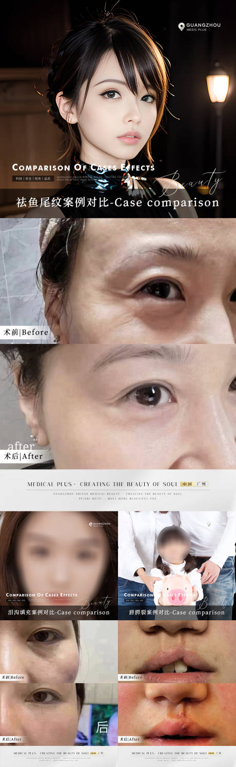 源文件下載【享設計】搜索編號：20760017757778882【最新醫美案例系列海報】