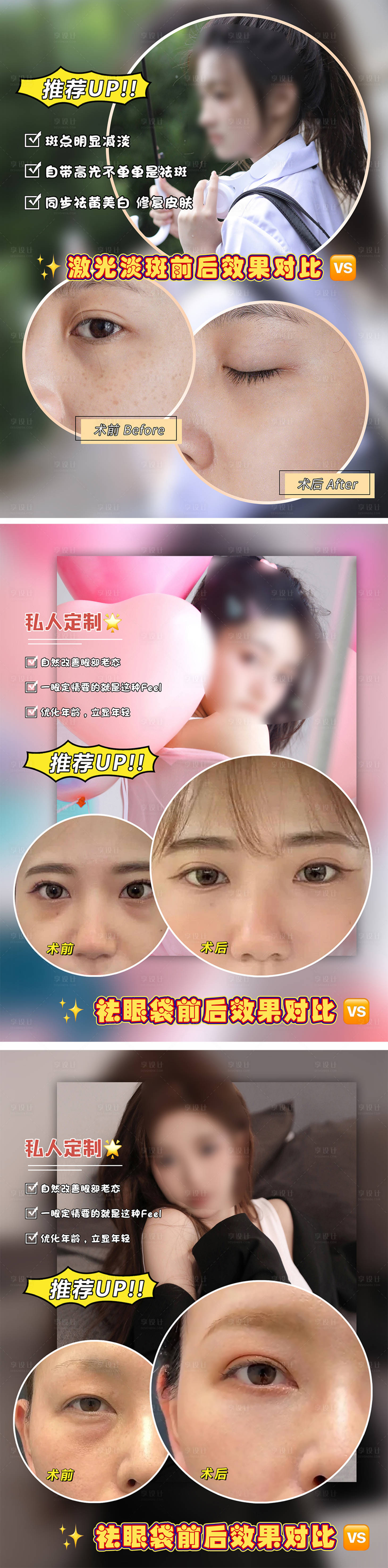 源文件下载【享设计】搜索编号：49840018280531941【医美案例对比模版】