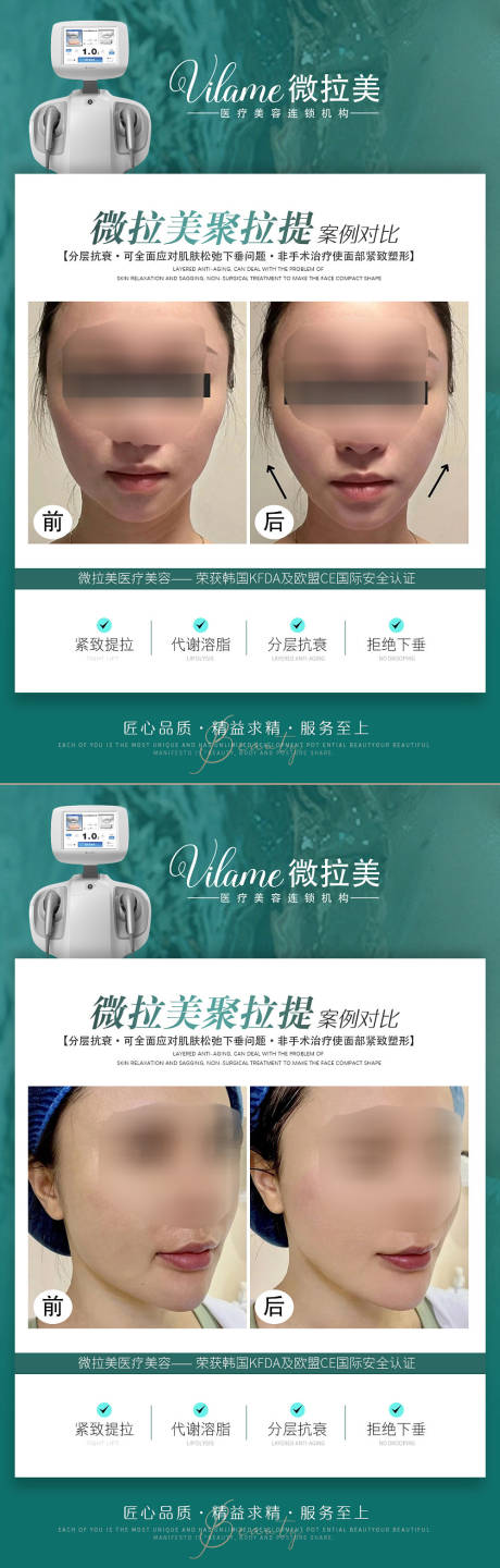 源文件下載【享設(shè)計(jì)】搜索編號：72820017985126818【醫(yī)美案例對比圖海報(bào) 】