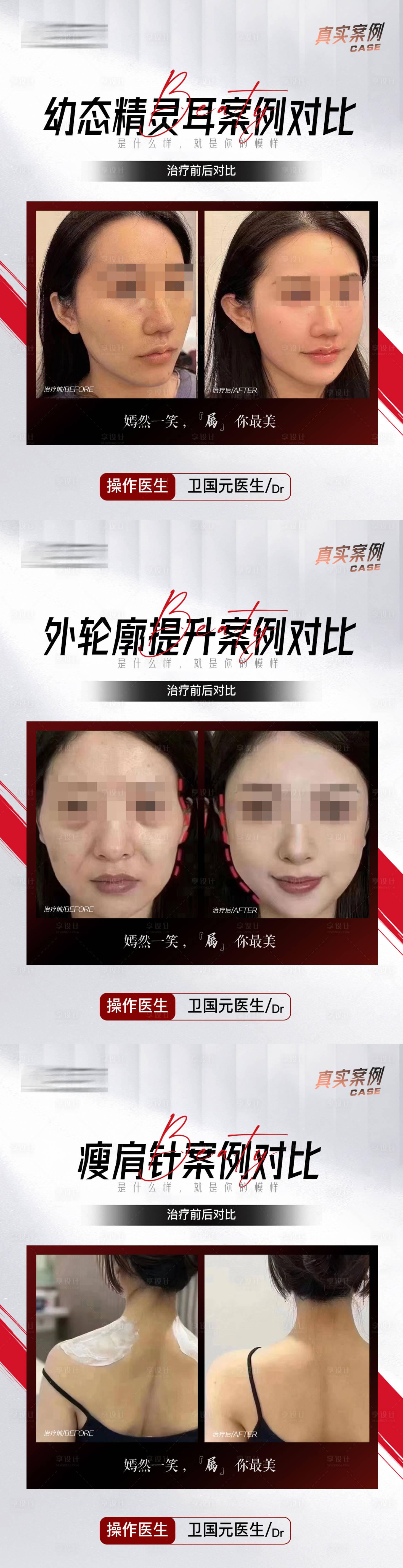 源文件下載【享設(shè)計(jì)】搜索編號(hào)：75190017757752979【整形簡(jiǎn)約案例合集】