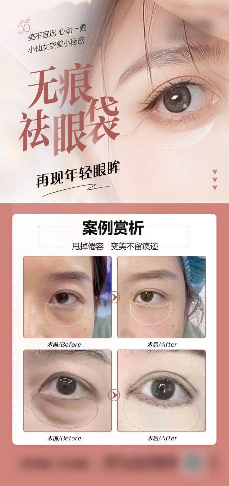 源文件下载【祛眼袋医美海报】编号：21240018292059079