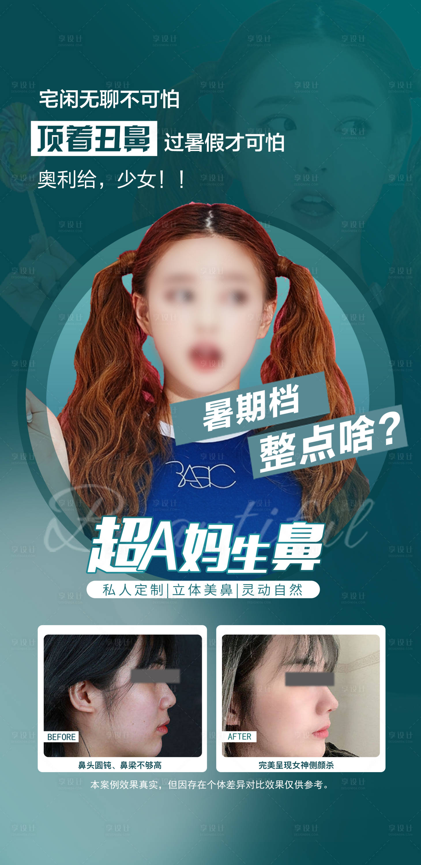 源文件下载【暑期鼻综合隆鼻】编号：66810018160504213