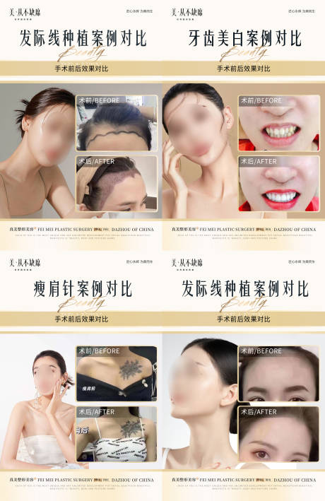 源文件下载【医美整形植发口腔案例海报】编号：21340018399629250