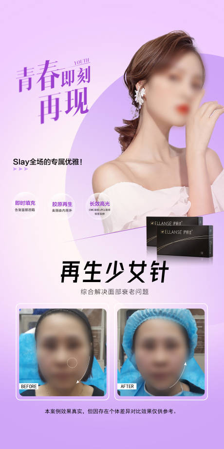 源文件下载【伊妍仕少女针海报】编号：53830018290385589