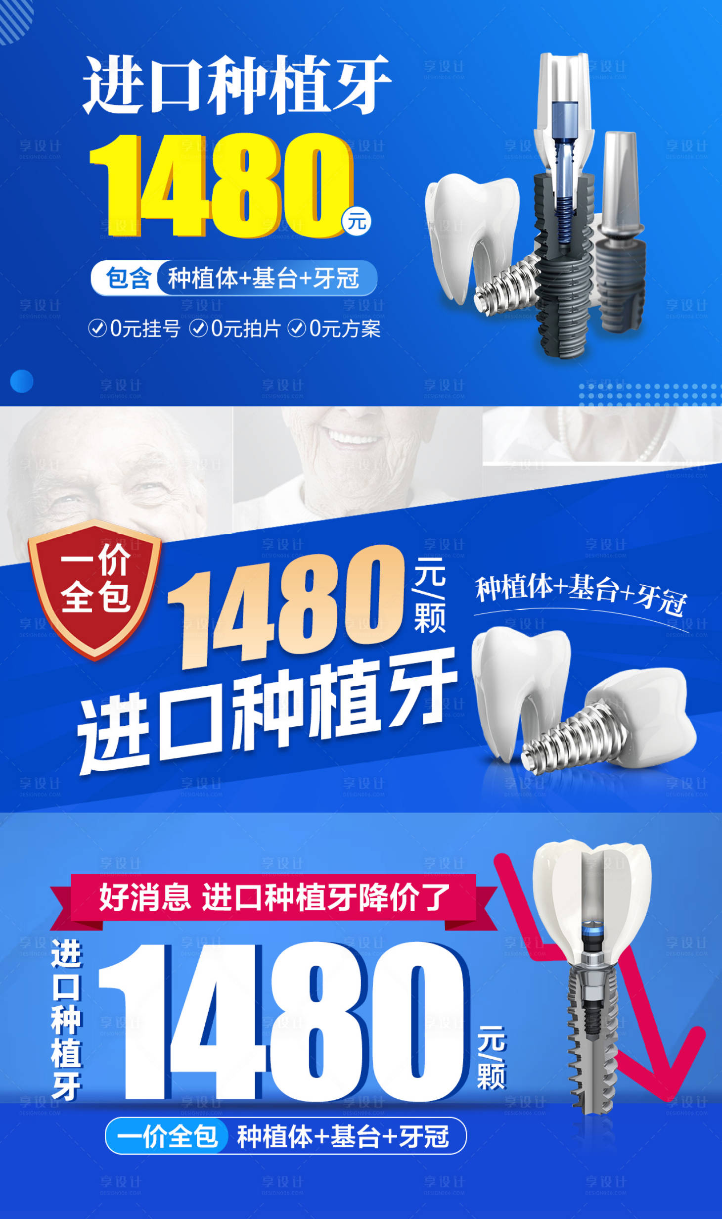 源文件下载【享设计】搜索编号：70440017872535133【种植牙头图合集】