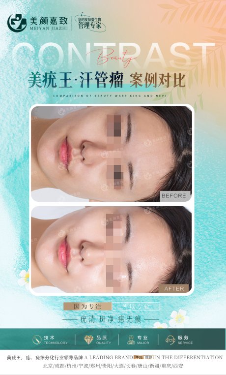源文件下載【享設計】搜索編號：91250018384266426【夏日感醫美案例海報】