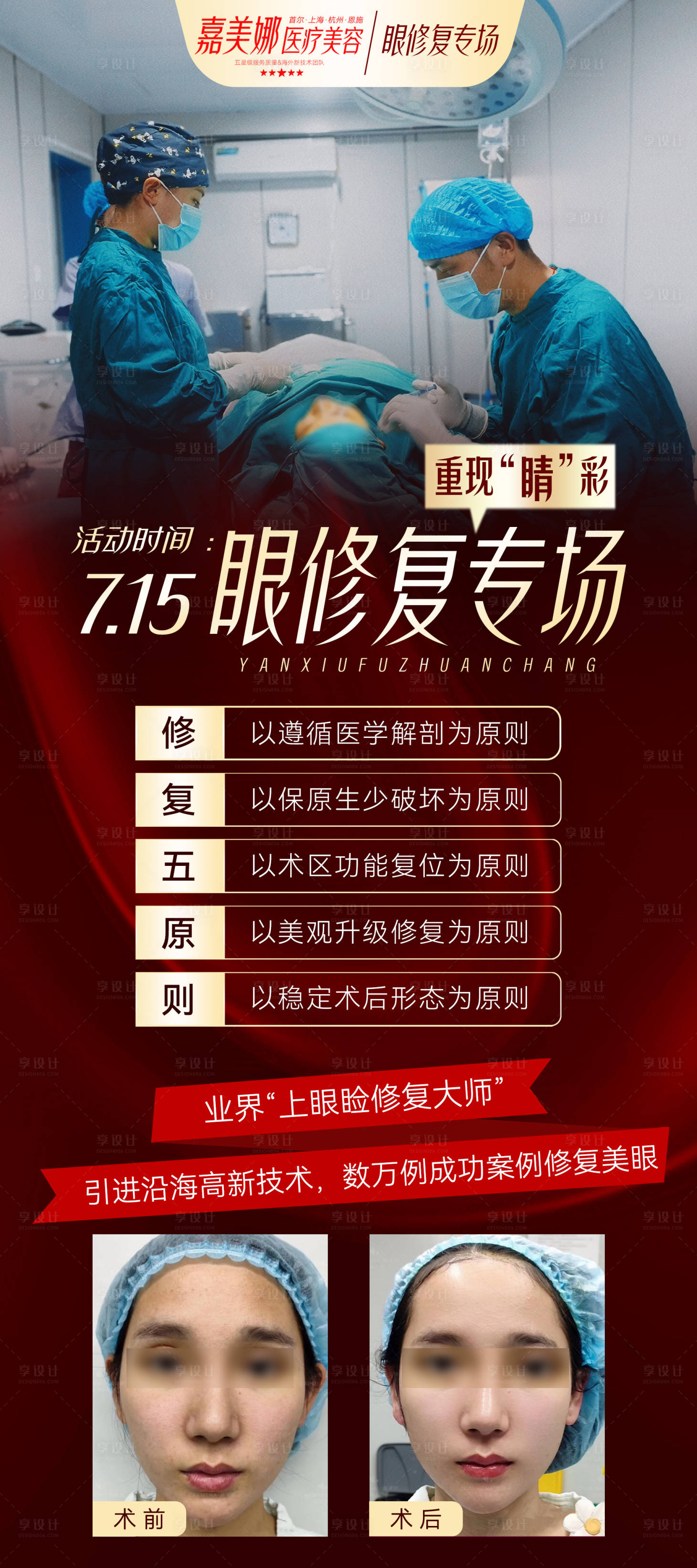 源文件下载【眼修复长图】编号：80160017999672936
