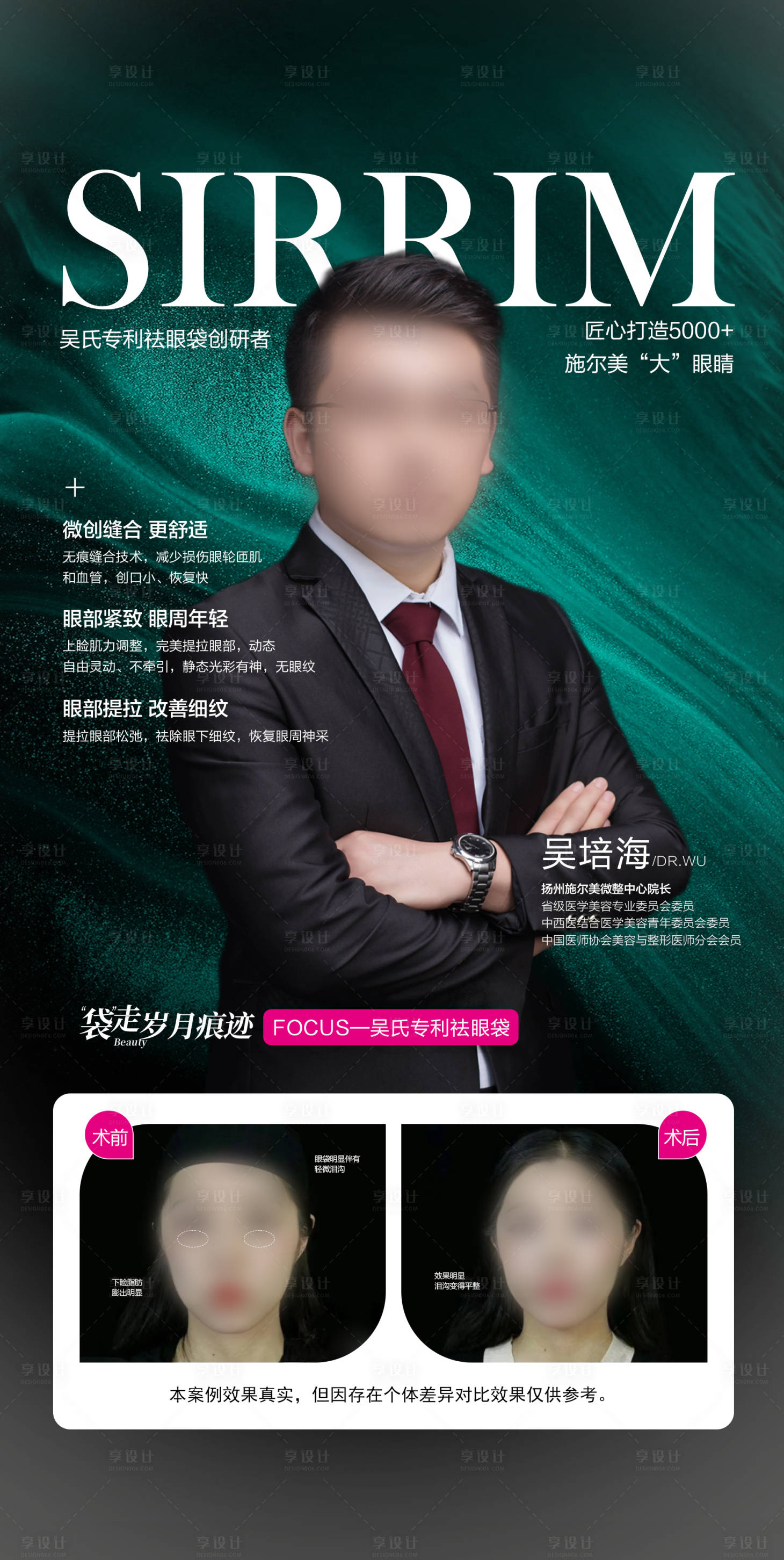 源文件下载【享设计】搜索编号：15970018302462286【双眼皮眼综合】