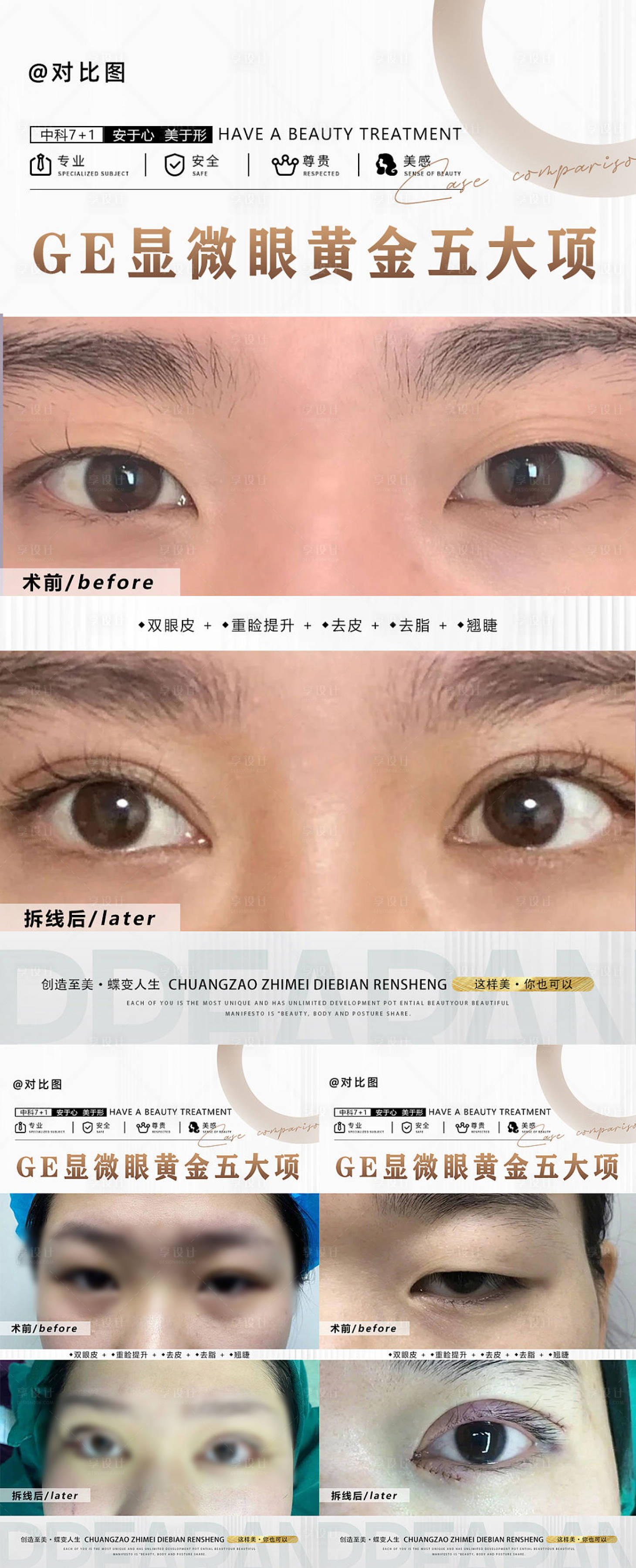 源文件下載【享設計】搜索編號：44700018206308853【醫(yī)美對比案列海報】