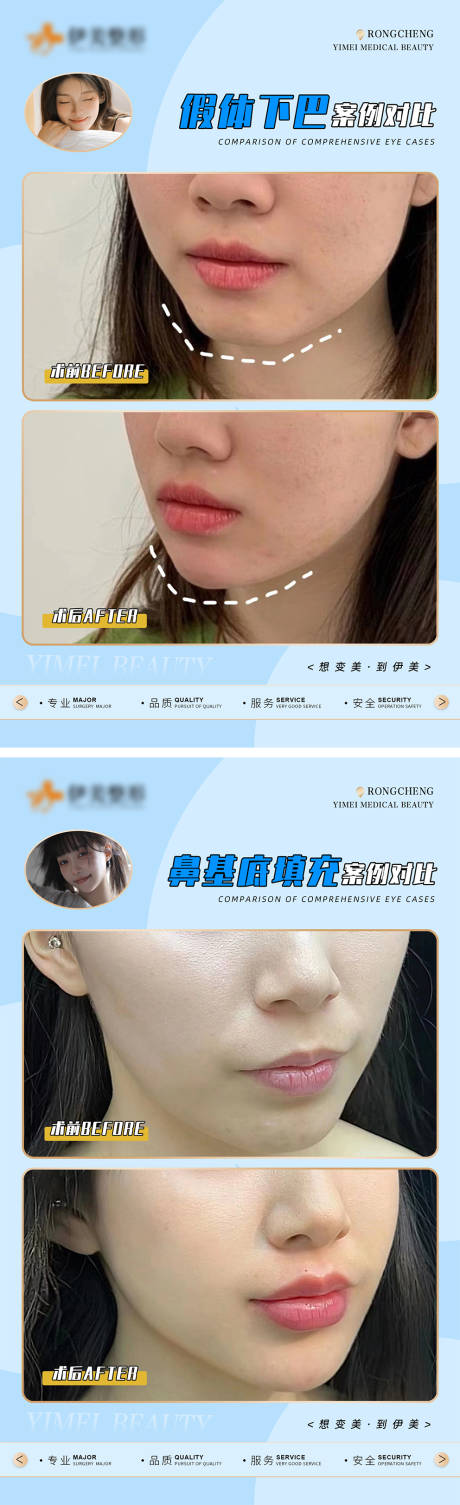 源文件下载【医美案例对比模版海报】编号：66240018314246869