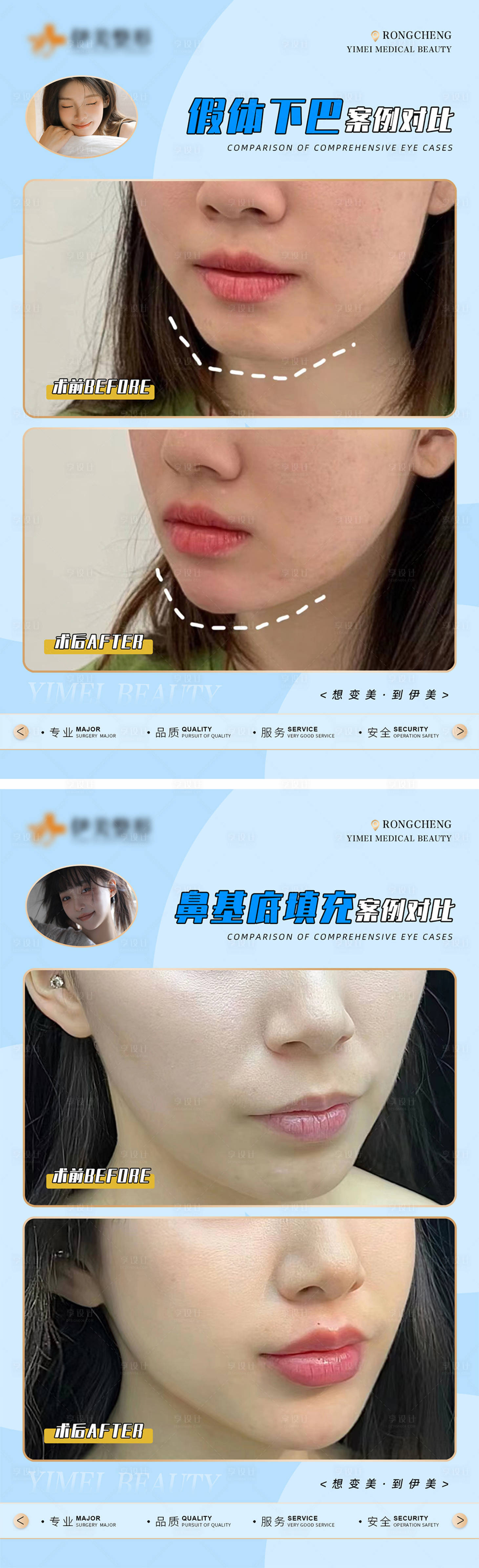 源文件下载【享设计】搜索编号：66240018314246869【医美案例对比模版海报】