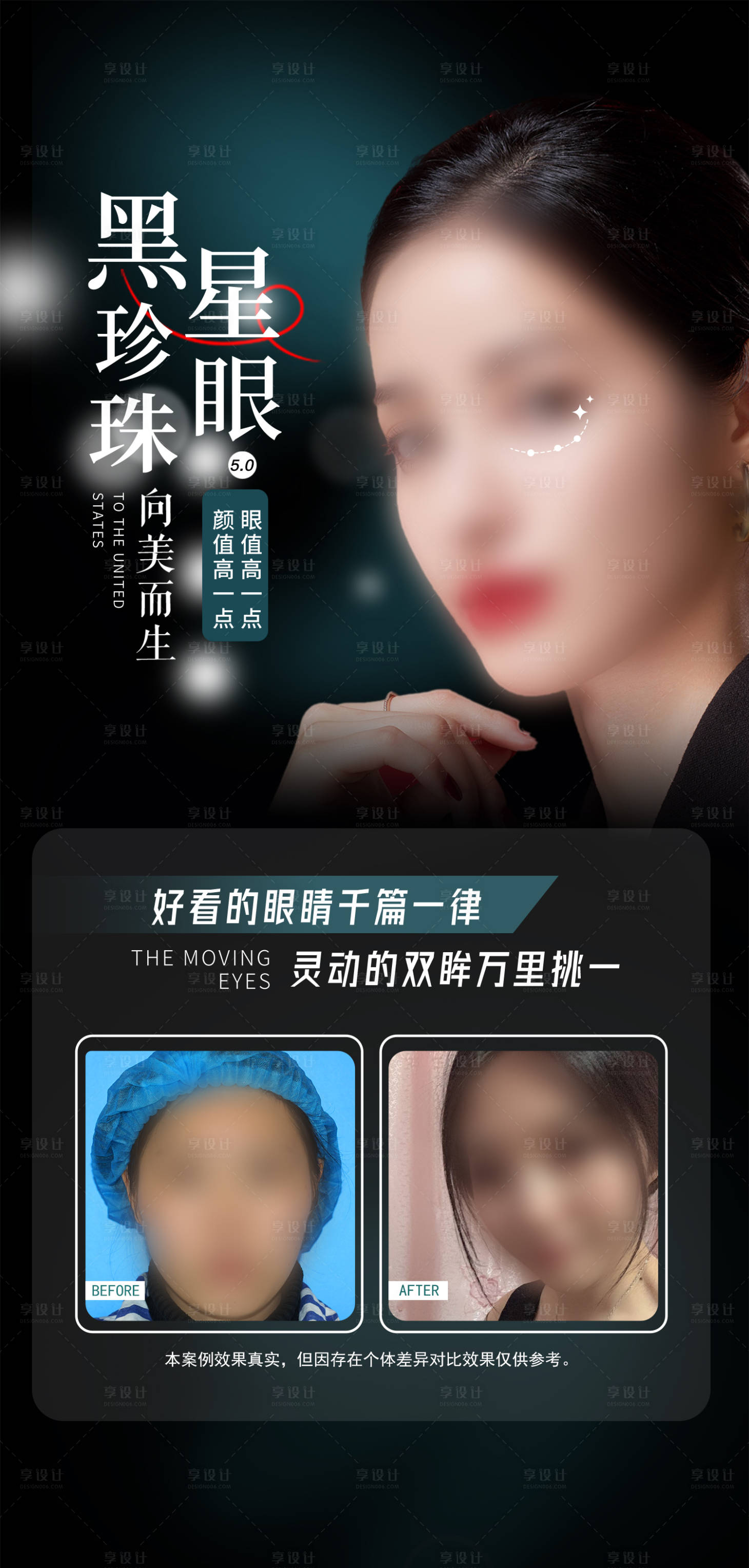 源文件下载【享设计】搜索编号：17170018266658249【双眼皮案例海报】