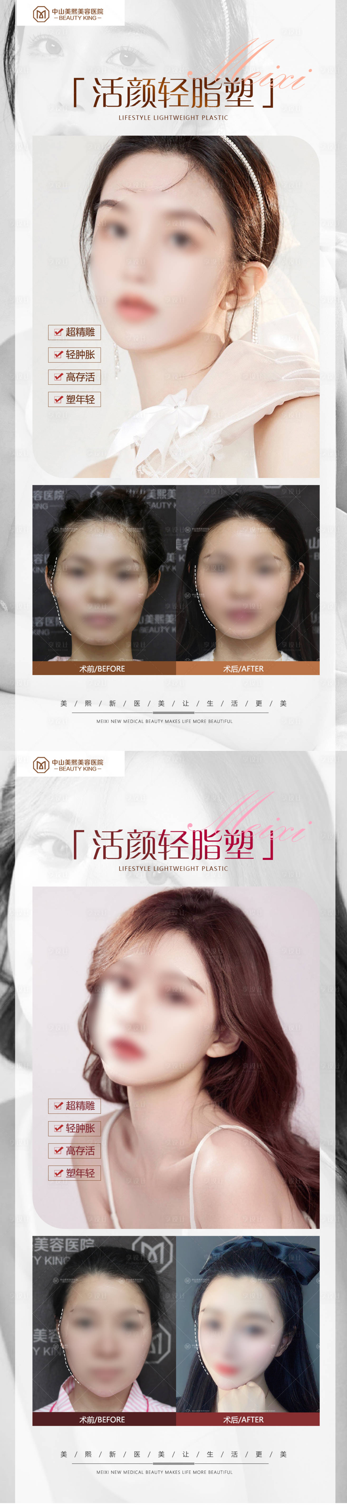 源文件下載【享設(shè)計】搜索編號：82460017855633580【醫(yī)美臉部填充案例海報】