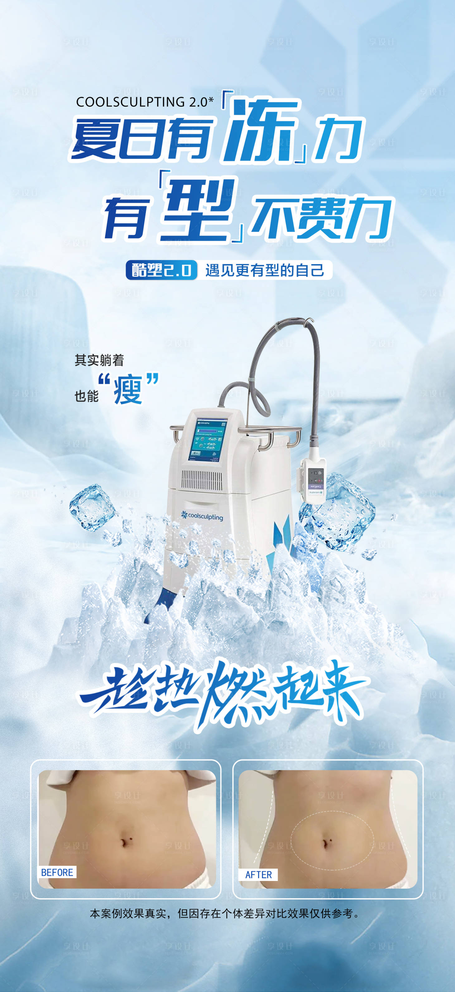 源文件下載【享設計】搜索編號：82610018362801716【酷塑冷凍減脂海報】