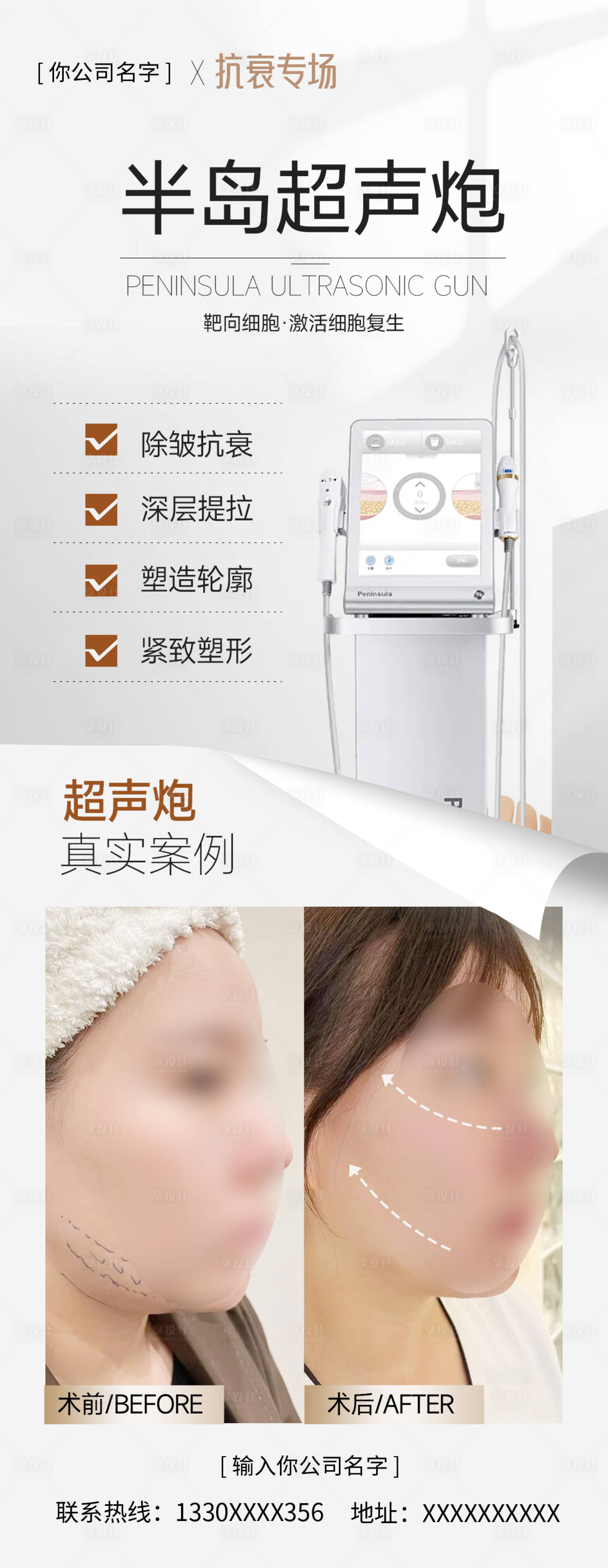 源文件下载【半岛超生炮案例海报】编号：55160017970868285