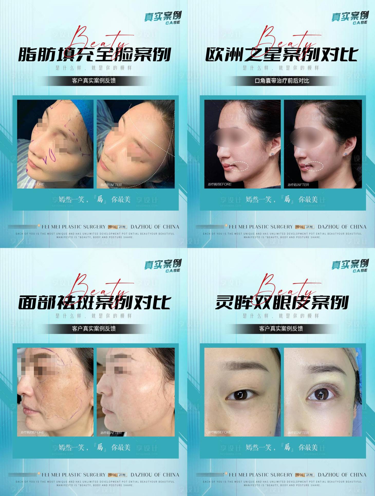源文件下载【享设计】搜索编号：58350018173429233【医美案例合集】