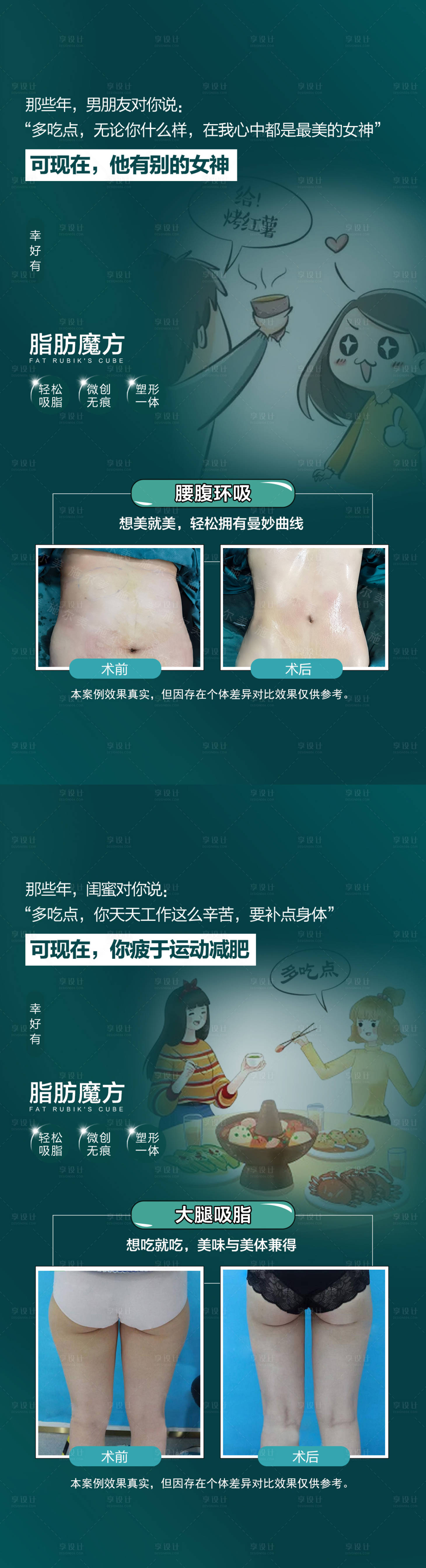 源文件下載【享設(shè)計】搜索編號：24120018176261769【吸脂 】