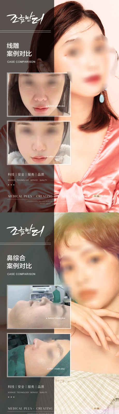 源文件下载【医美案例】编号：22220018080349740