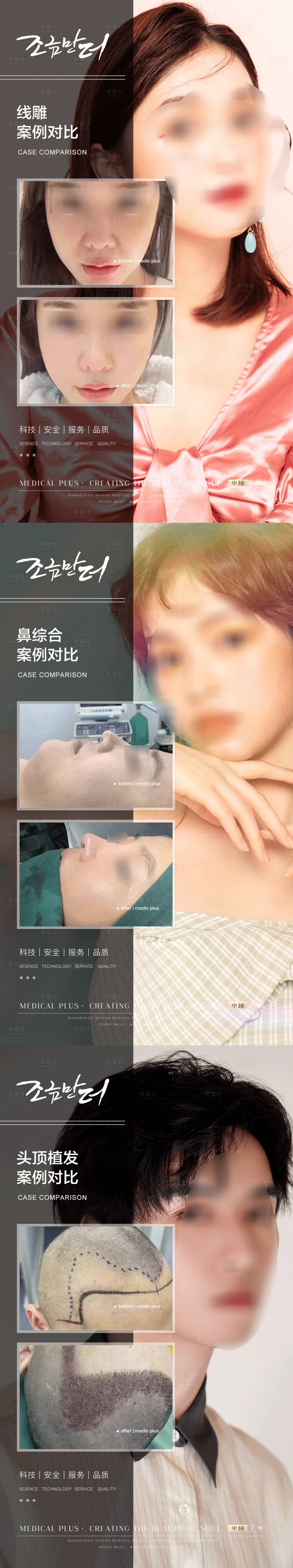 源文件下载【医美案例】编号：22220018080349740