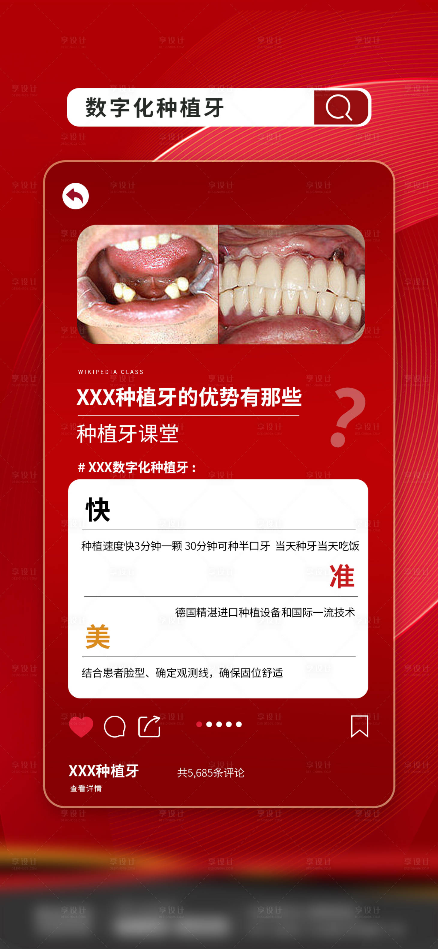 源文件下载【口腔种植牙优势】编号：92420018077334063