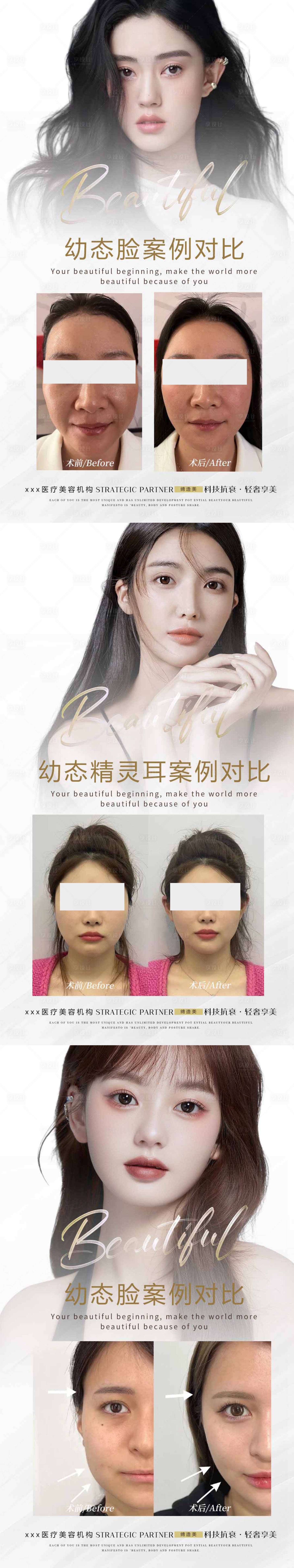 源文件下載【享設計】搜索編號：12030017746422232【醫美案例對比系列海報】