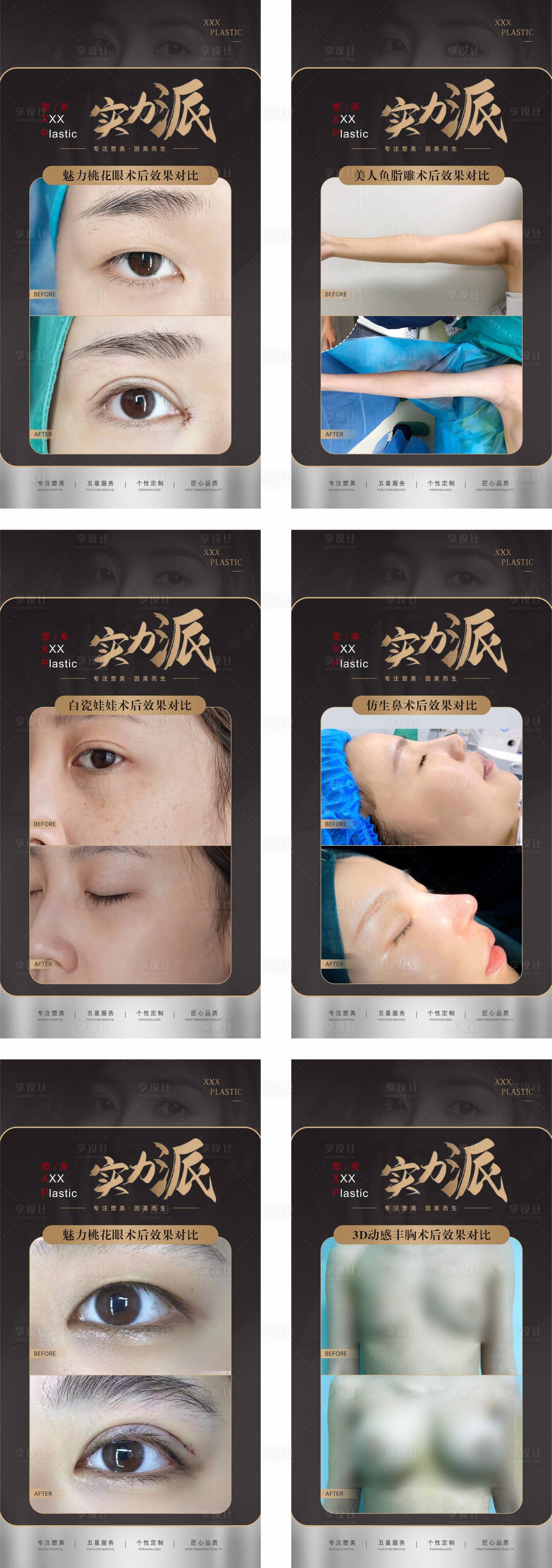 源文件下載【享設(shè)計(jì)】搜索編號(hào)：71440017884461015【醫(yī)美整形美容案例對(duì)比海報(bào)】