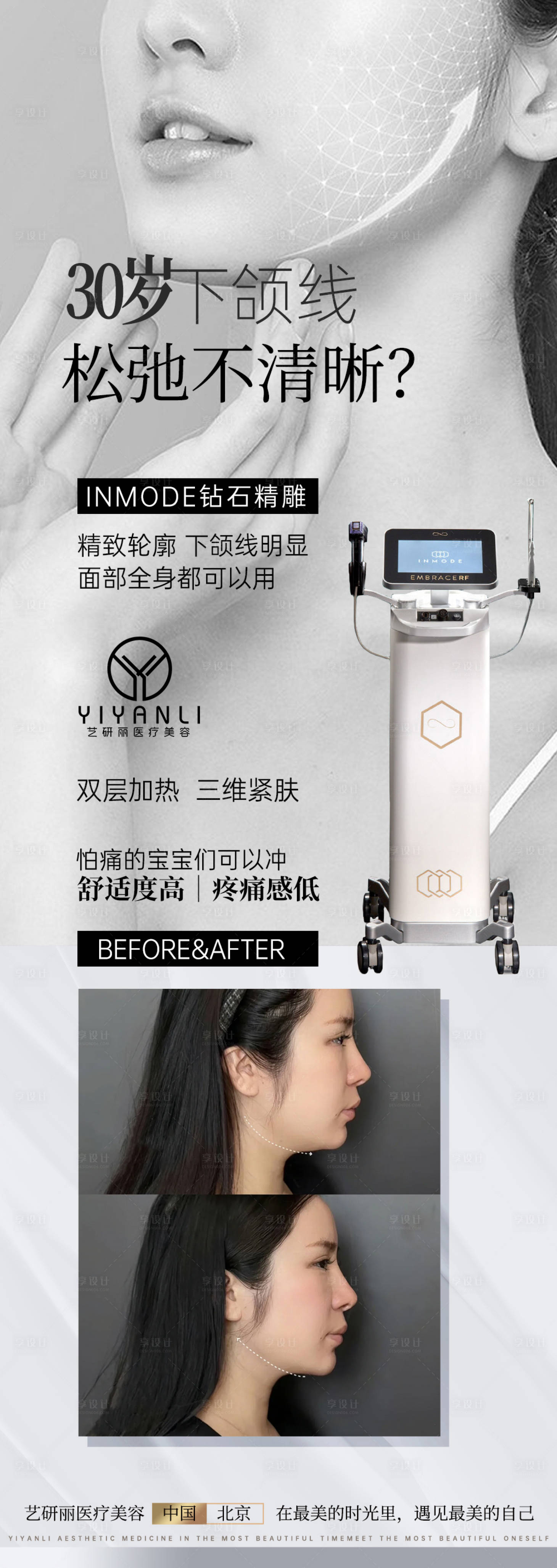 源文件下载【钻石超塑下颌线海报轻医美】编号：38630017963451252