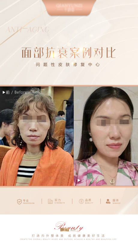 源文件下载【医美案例对比海报】编号：43320017785631634