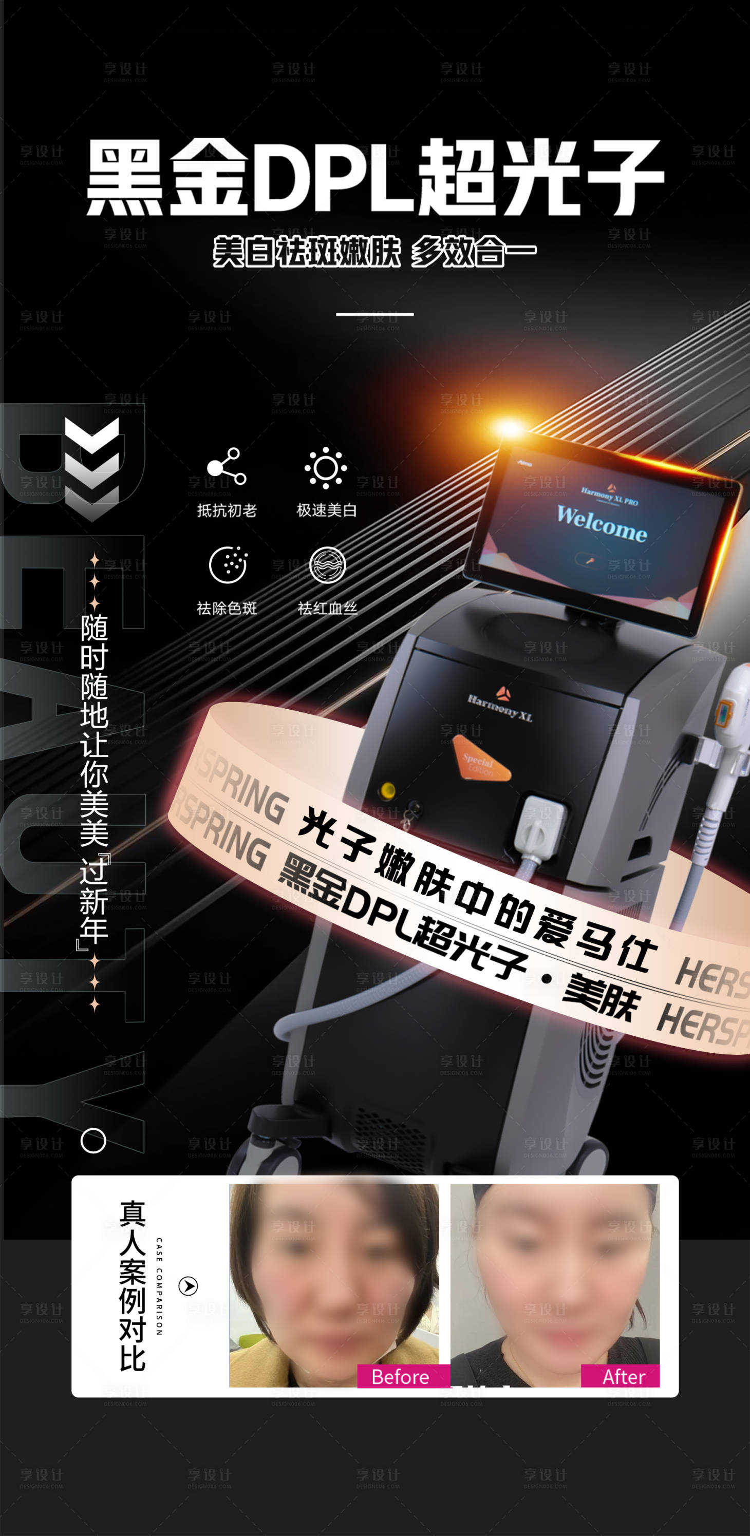 源文件下载【黑金DPL超光子】编号：47170018187627068