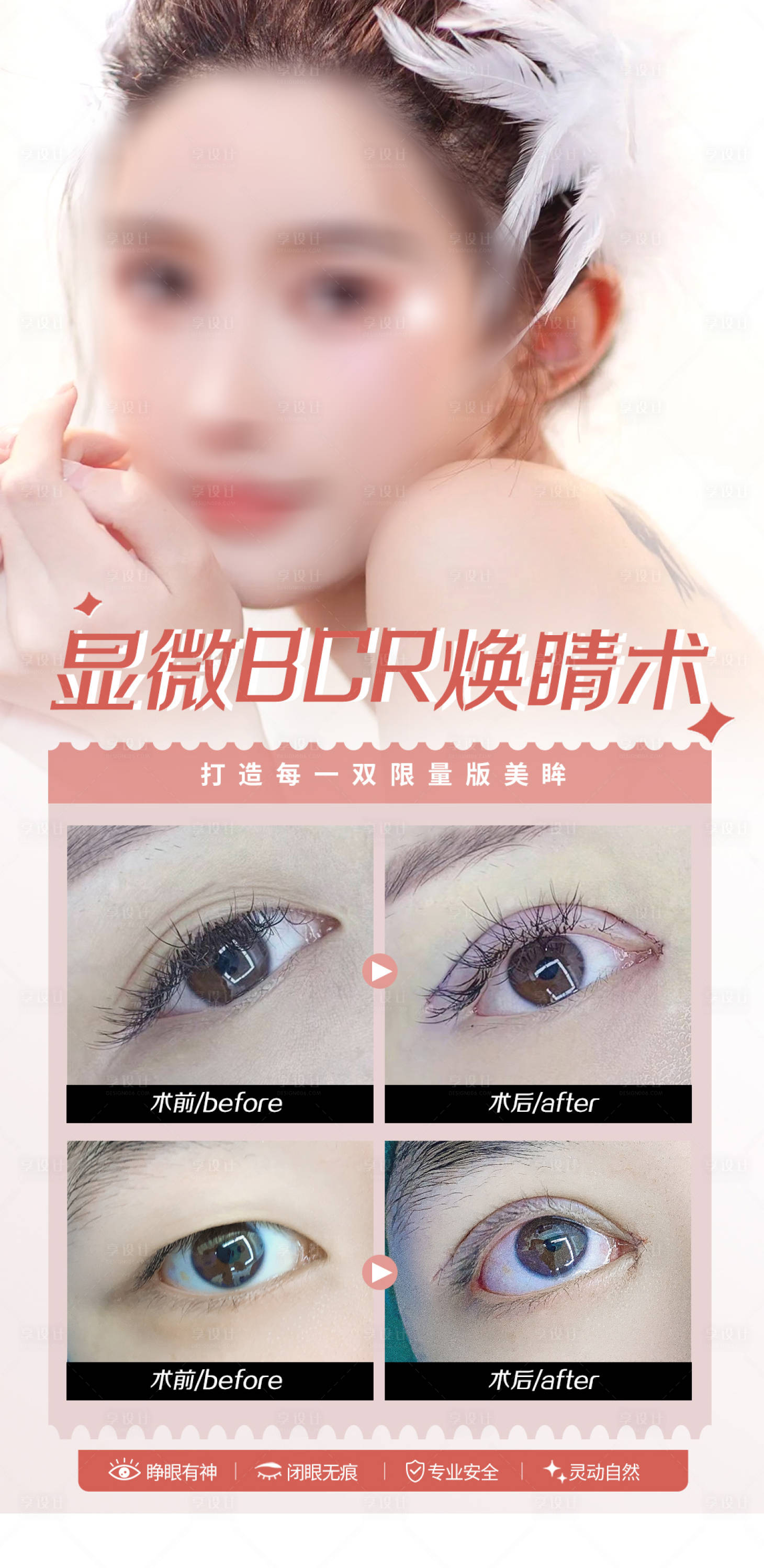 源文件下載【雙眼皮眼部案例醫美整形項目海報】編號：62730018198839418