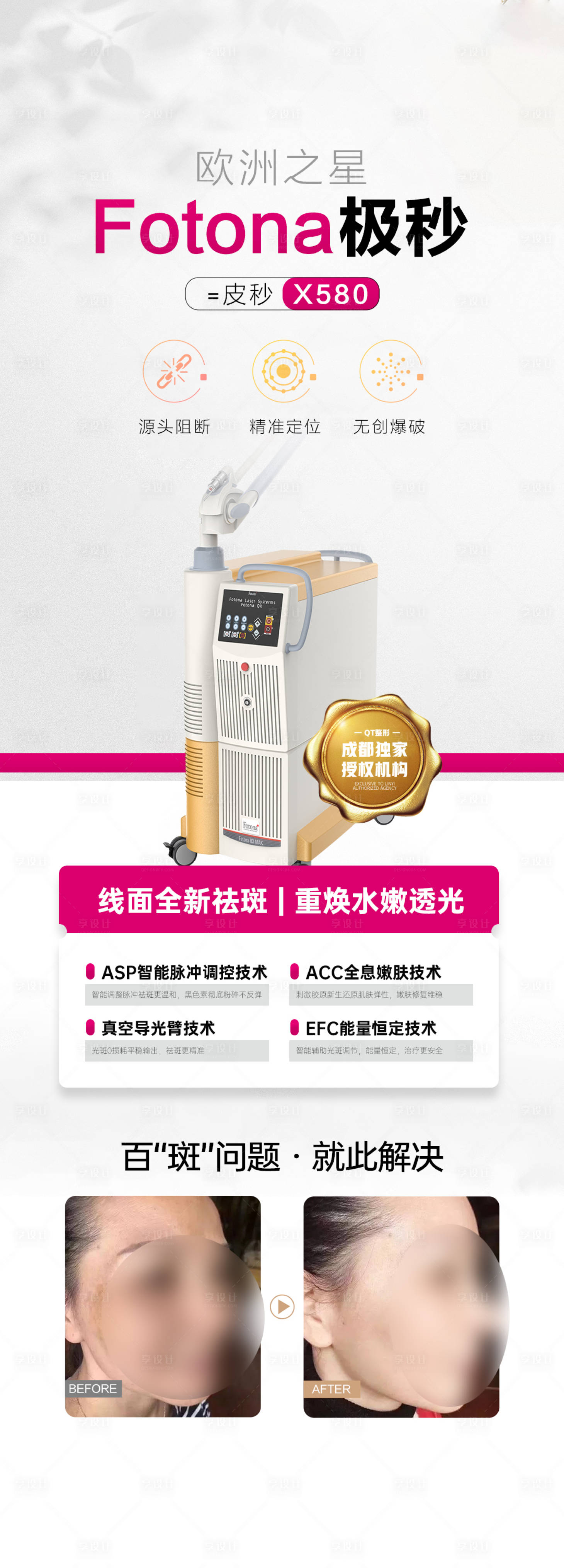 源文件下载【享设计】搜索编号：34720018233452108【医美星际极秒长图】
